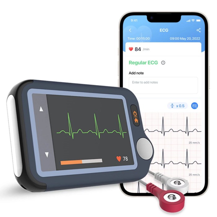 Mobile ECG devices for heart monitoring
